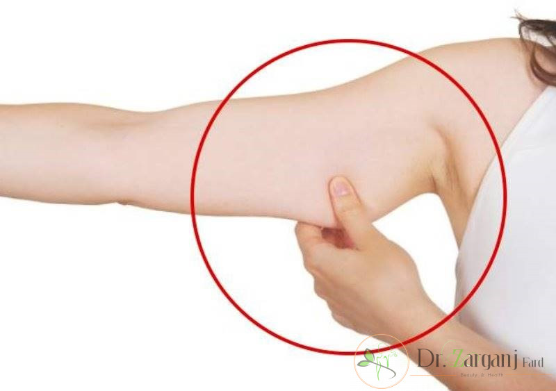 ماندگاری روش کربوکسی تراپی بازو به چه میزانی است؟
