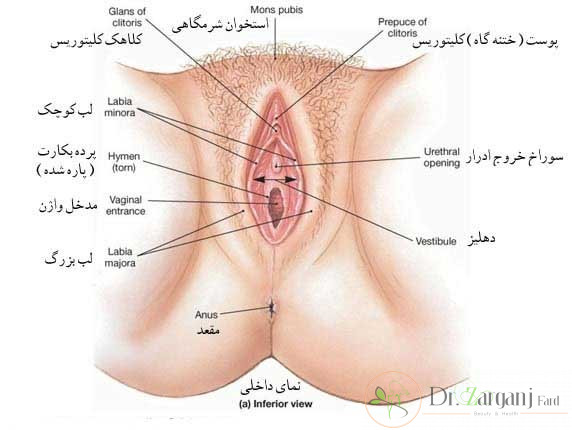 هزینه انجام عمل جراحی لابیاپلاستی به چه عواملی بستگی دارد؟