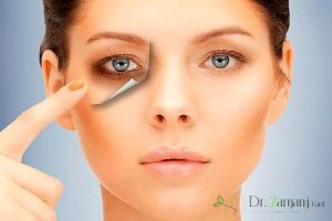 درمان کربوکسی تراپی چگونه صورت می گیرد؟