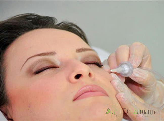 ویژگی منحصر به فرد روش کربوکسی تراپی مهم است