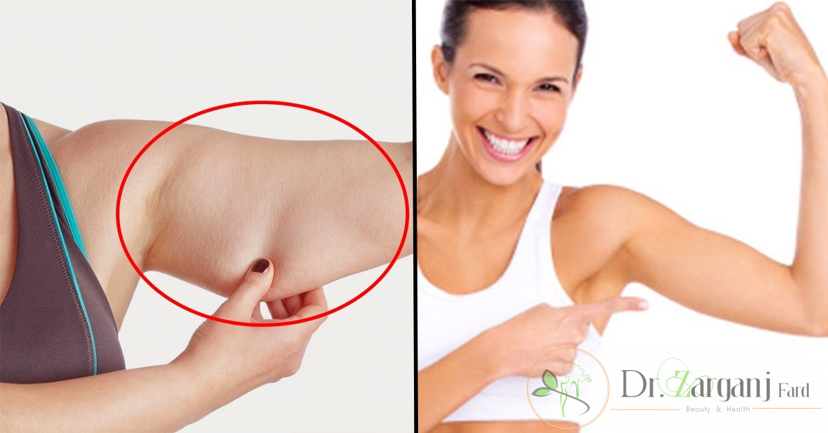 بعد از انجام کربوکسی تراپی بازو چه نکاتی را باید رعایت کنید؟