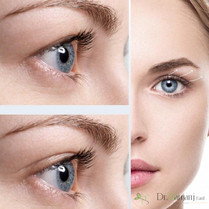 پلاسما جت چیست؟