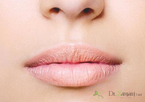 چه افرادی کاندیدای مناسبی برای تزریق ژل لب هستند؟