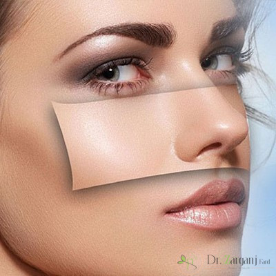 از بین بردن رنگدانه های پوست با لیزر