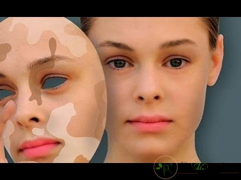 بعد از انجام لیزر درمانی باید چه مراقبت هایی از پوست داشته باشیم؟