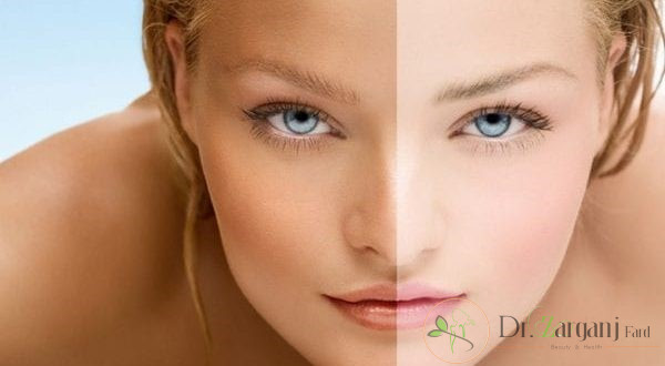از بین بردن رنگدانه های پوست با استفاده از لیزر چه نتایجی دارد؟
