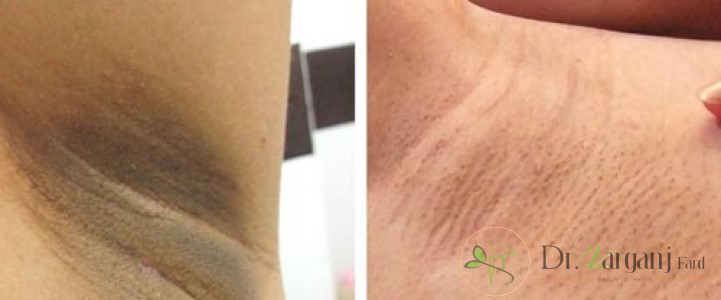 چه دلایلی باعث ایجاد این تیرگی ها می شوند؟