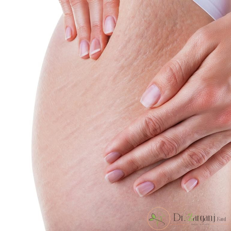 برخی از ویژگی های منحصر به فرد کربوکسی تراپی به شرح زیر می باشند: