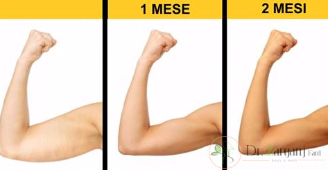 قبل از انجام کربوکسی تراپی بازو به چه نکاتی باید توجه داشت؟