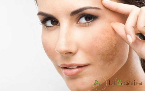 روشن کردن پوست و برطرف کردن سیاهی آن از چه طریقی انجام می شود؟