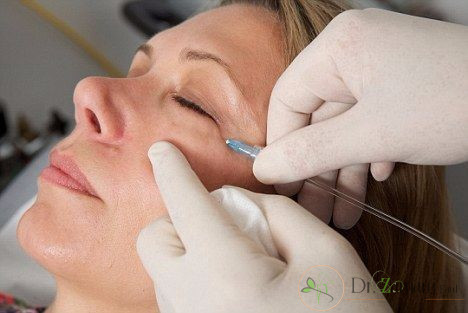 درباره کربوکسیتراپی چه اطلاعاتی دارید؟