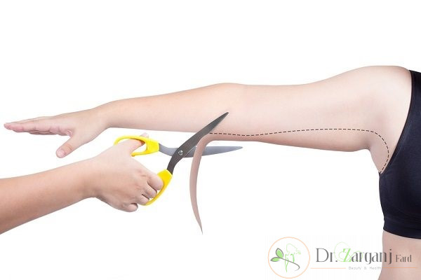 انجام کربوکسی تراپی بازو چه مزیت هایی دارد؟