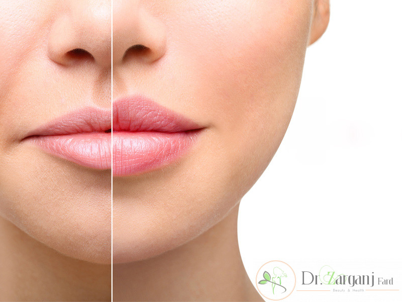 مزایای استفاده از هیالورونیک اسید چیست؟
