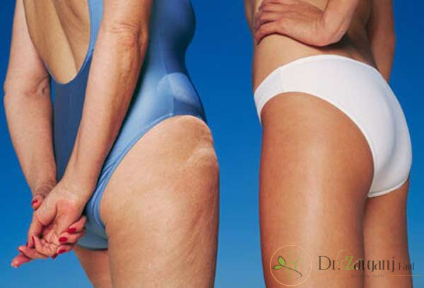پزشک عمل کربوکسی تراپی باید چه ویژگی هایی داشته باشد؟