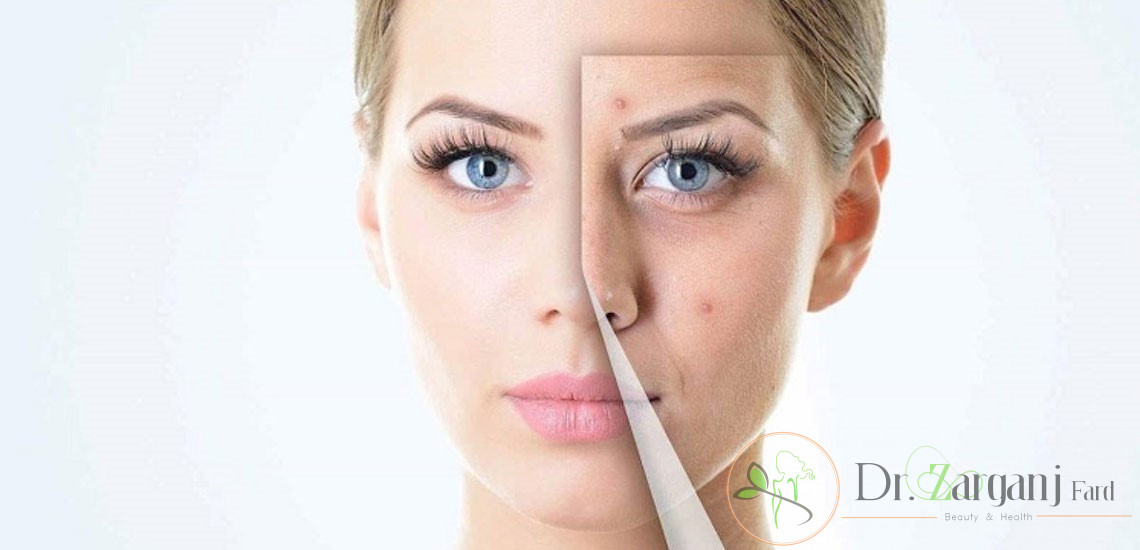 تعداد جلسات کربوکسی تراپی غیر تهاجمی