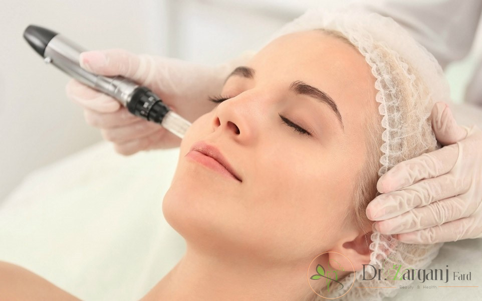 دقت لیزر