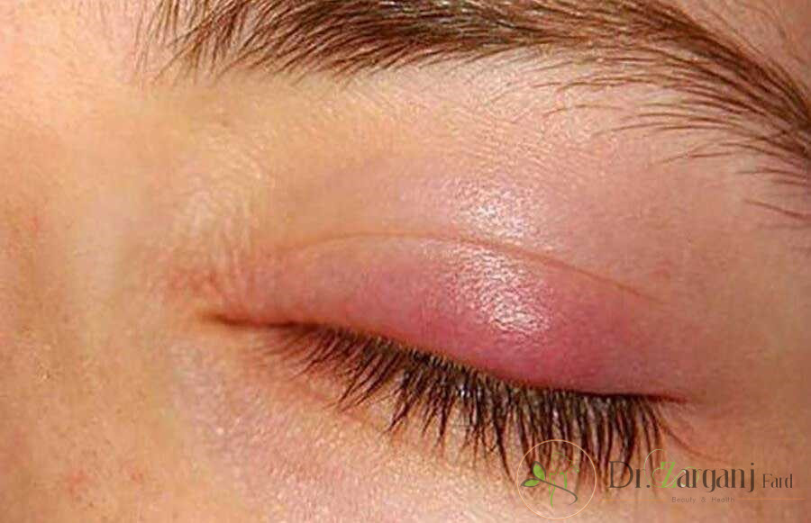 گل مژه:
