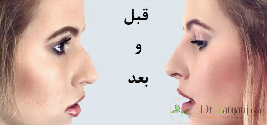 ترس از بی هوشی
