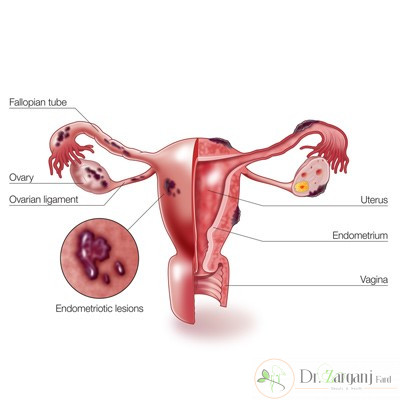آیا می دانید استفاده از لیزر برای جوان سازی واژن چه اختلالاتی را برطرف می کند؟