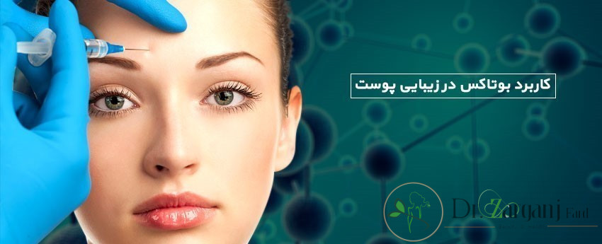 بوتاکس