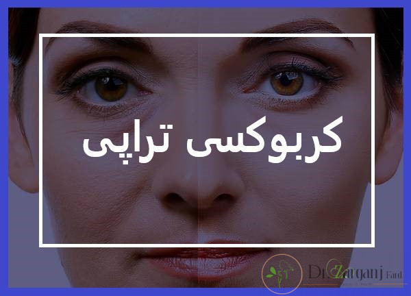 تفاوت چهارم