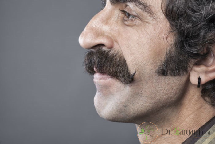 بینی عقابی: