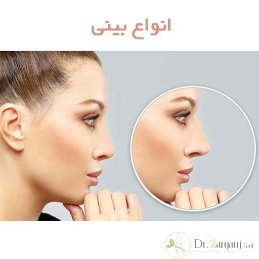 انواع بینی: