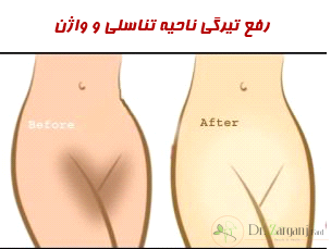 افزایش سن در افراد: