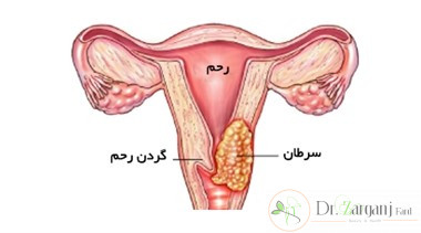 درباره زیباسازی و جوان سازی واژن از طریق لیزر مونالیزا تاچ چه میدانید؟