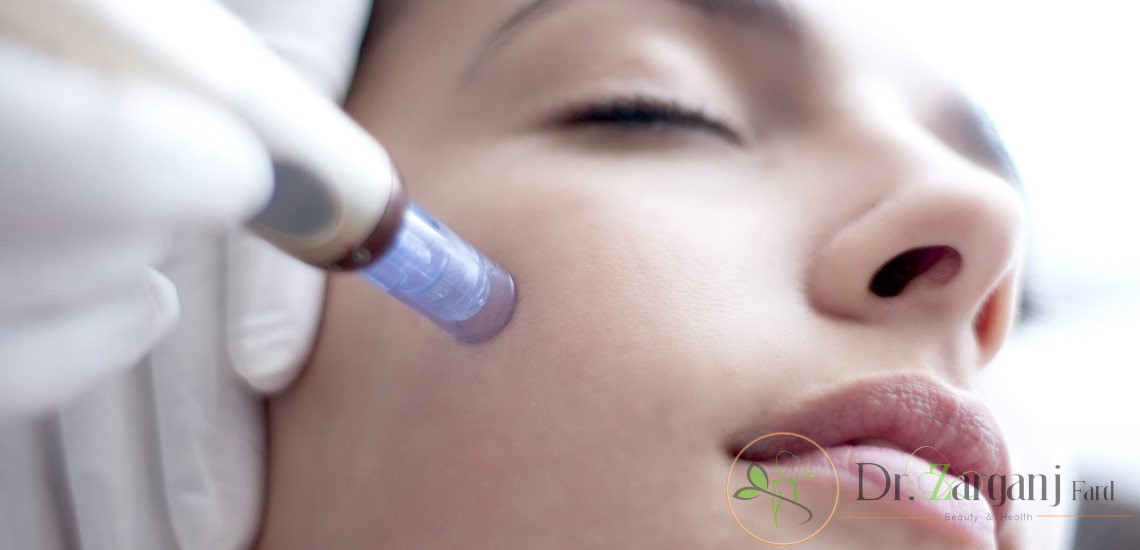 در روش های کربوکسی تراپی و مزوتراپی نقطه تزریق چگونه مشخص می شود؟