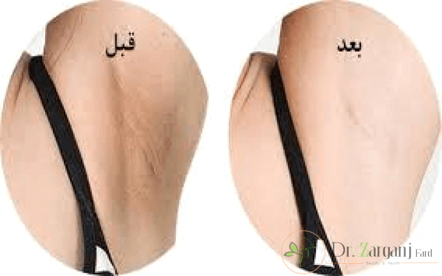 استفاده از پمادهای تجویزی: