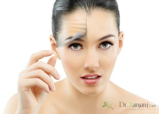 باید ها و نبایدهای حین بوتاکس: