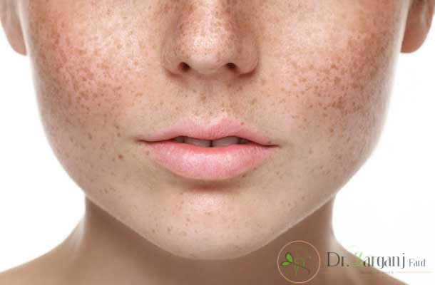 چندین تزریق کوچک صورت می گیرد