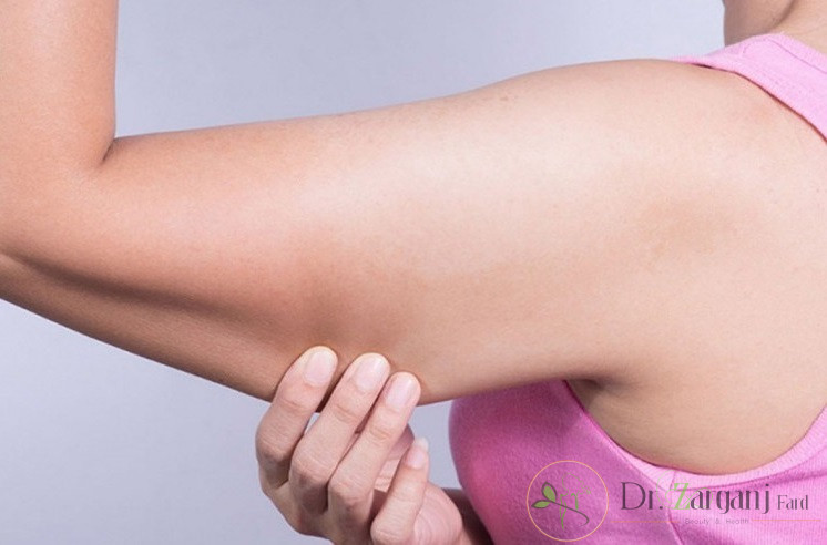 پاتوفیزیولوژی سلولیت