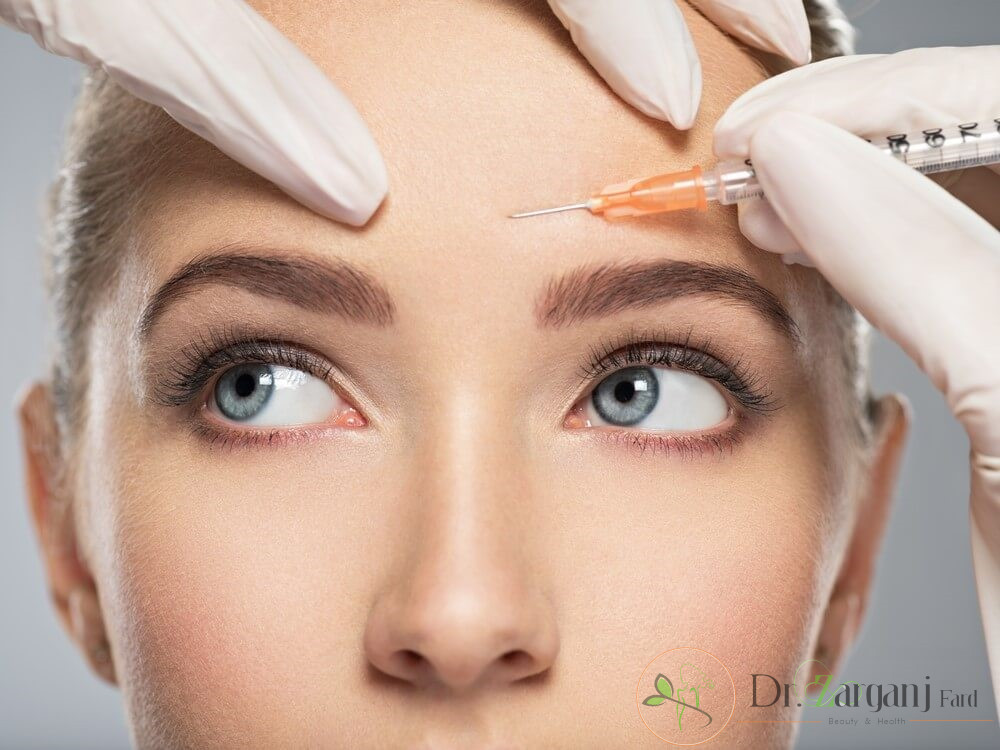 بوتاکس در ناحیه خط اخم چیست؟