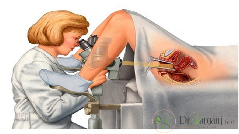 تعداد جلسات تنگ کردن واژن با لیزر چقدر است؟
