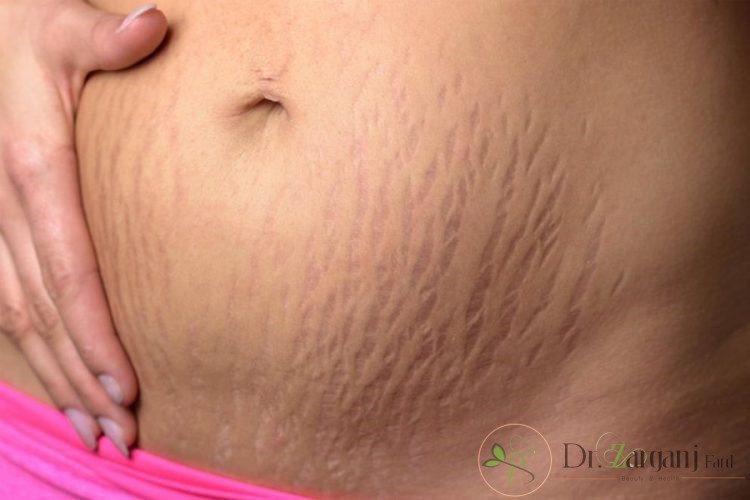 روش کربوکسی تراپی یک روش درمانی کم خطر و بسیار ساده می باشد