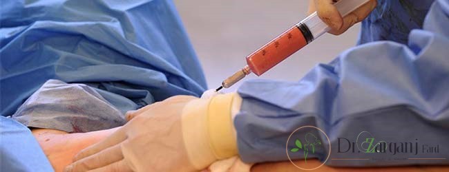 چگونه می توانیم برای تزریق چربی به باسن یک پزشک خوب را انتخاب کنیم؟