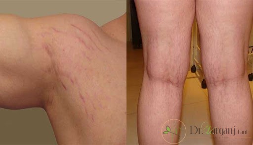 مشکل در نظر گرفته برای شما و ترک های پوستی