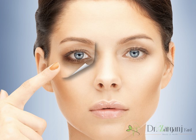 ایمنی کربوکسی تراپی در چه حدی می باشد؟ آیا این روش درصد ایمنی بالایی دارد؟