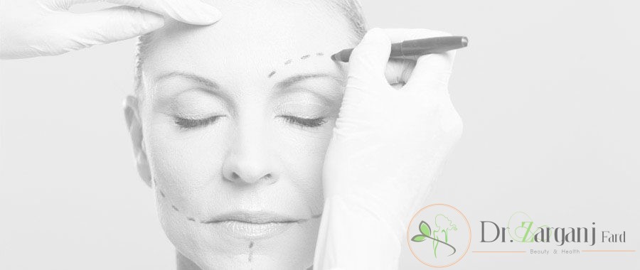 افراد ایده آل برای کاشت چربی چه کسانی می باشند؟