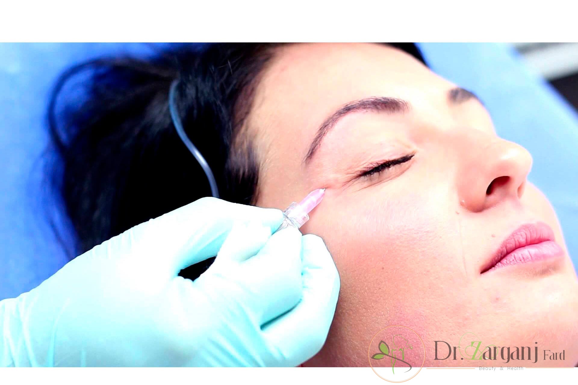 آیا روش کربوکسی تراپی زیر چشم در بیماران درد دارد؟