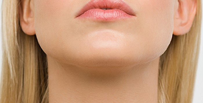 ماندگاری تزریق چربی به چانه