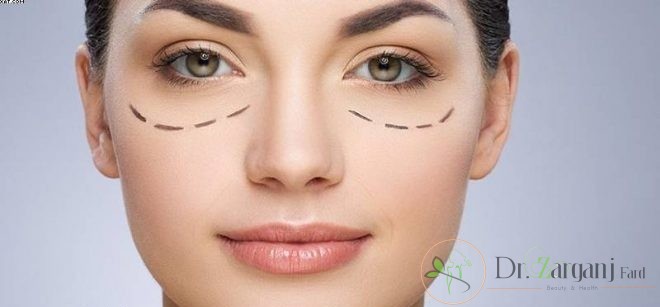 تزریق چربی به هیچ عنوان دچار عفونت نخواهد شد