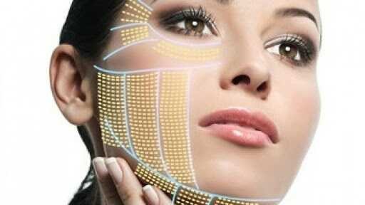 عوارض احتمالی آر اف برای لک صورت چیست؟!