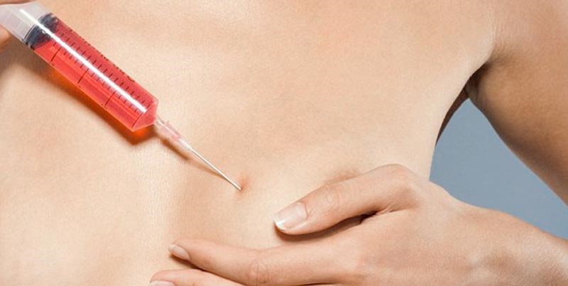 دکتر تزریق چربی باید تکنیک های پیشرفته روز دنیا را به کار گیرد:
