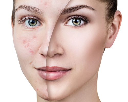 راه های درمانی برای لک صورت چیست؟