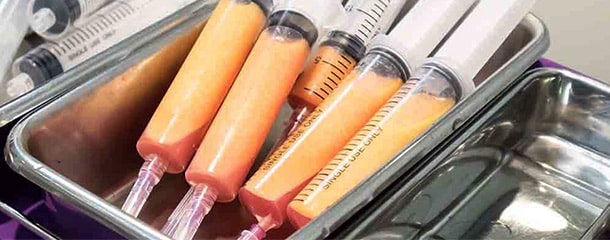 نحوه انجام عمل تزريق چربي به سينه در شيراز چگونه است؟