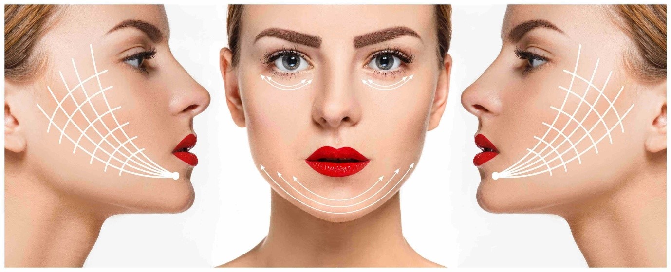 تاثیر روش درمانی آر اف برای لک صورت چقدر است؟
