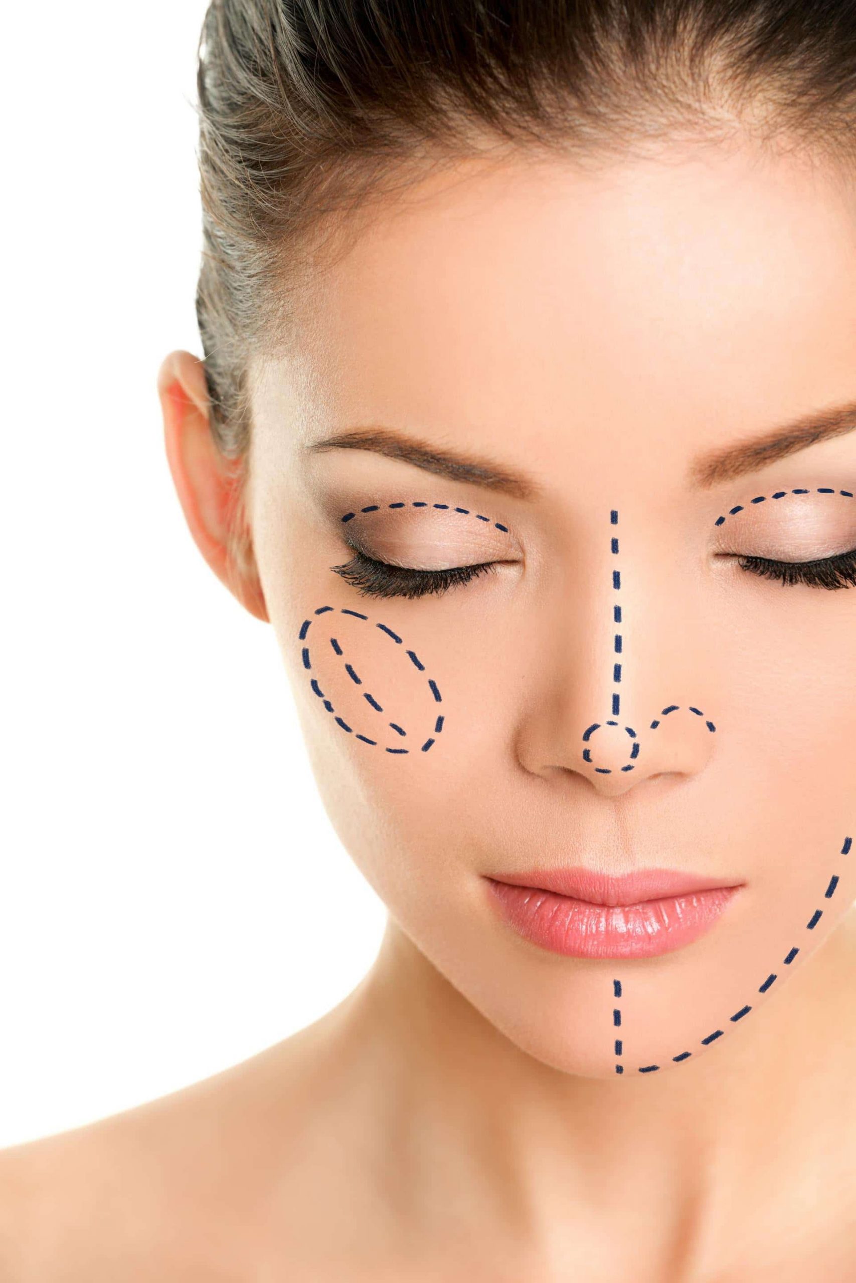 آیا انتقال و تزریق چربی ایمن است؟